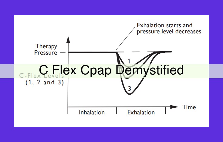 C-Flex CPAP: A Revolutionary Solution for Obstructive Sleep Apnea (OSA) with Reduced Exhalation Effort
