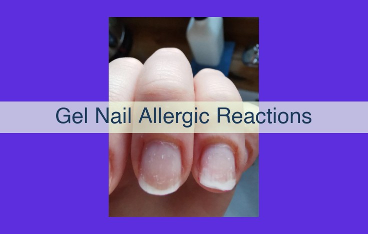 Gel Nail Allergic Reactions: Causes, Symptoms, Diagnosis, and Treatment